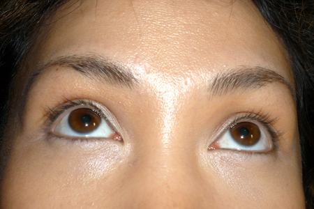 Before